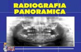 Radiografia panoramica