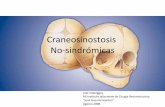 Craneosinostosis No Sindromicas