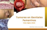 Tumores en genitales femeninos patologia