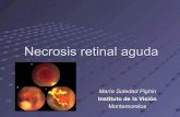 Necrosis retinal aguda
