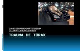 Trauma De TóRax