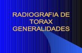 Generalidades de la Radiología De Tórax