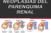 Neoplasias del parenquima renal