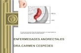 Enfermedades anorrectales