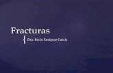 Radiología - Fracturas