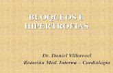 Bloqueos e hipertrofias (completo)