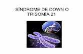 Sãndrome de down o trisomia 21 presentacion