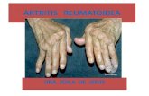 Artritis   reumatoidea  nuevo tema
