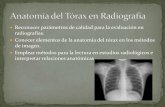 Anatom­a del t³rax en radiograf­a