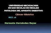Cancer Gastrico Hernesto Hdz