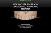 Seminario 4. Encerado Diagnóstico y Enfilado Dentario