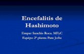 Encefalitis de hashimoto