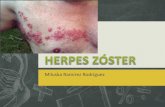 Herpes zóster dermatología