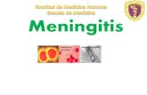 Meningitis lewis