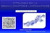 Granulomatosis linfomatoide