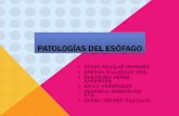 Patologias  del esofago