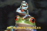 Problemas visuales (2)