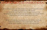 Endocarditis infecciosa