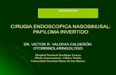 Cirugia endoscopica en el papiloma nasal