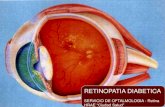 OFTALMOLOGIA: "Retinopatia Diabetica"