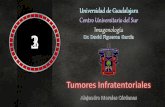 Tumores Infratentoriales