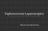 esplenectomia laparoscópica