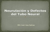 Neurulacion y defectos del tubo neural