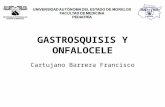 Gastrosquisis y onfalocele