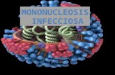 Mononucleosis infecciosa