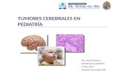 Tumores del sistema nervioso central en pediatría
