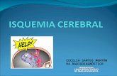 Isquemia cerebral