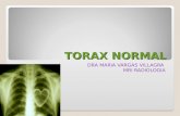 Rx torax normal