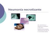 Neumonia necrotizante