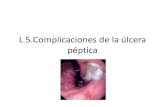 Complicaciones de la úlcera péptica