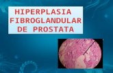 Hiperplasia glandular de prostrata