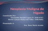 Neoplasia maligna de hígado