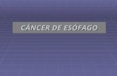 5. cáncer de esófago