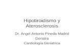 Hipotiroidismo y aterosclerosis