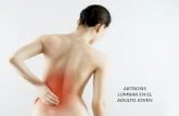 Artrosis lumbar
