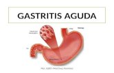 Gastritis aguda