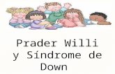 Prader Willi y Sindrome de Down