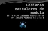 Lesiones Vasculares De Medula