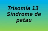 Trisomía 13  síndrome de patau
