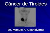 Cáncer de Tiroides- Dr. Manuel Usandivaras