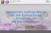 11.  imagenes radiograficas maxilar