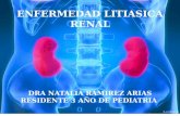 Litiasis renal en pediatria
