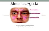 Sinusitis aguda Alumno: Fernández Gutiérrez Willignton Dr.: Guillermo Fonseca