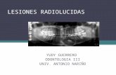 Lesiones radiolucidas-97