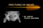 Fracturas de pelvis (pp tshare)