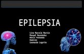Epilepsia en el lóbulo temporal (ELT)